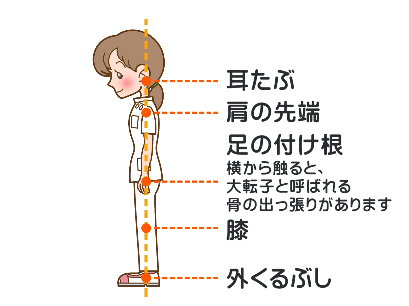 骨盤の歪みが猫背を引き起こす理由