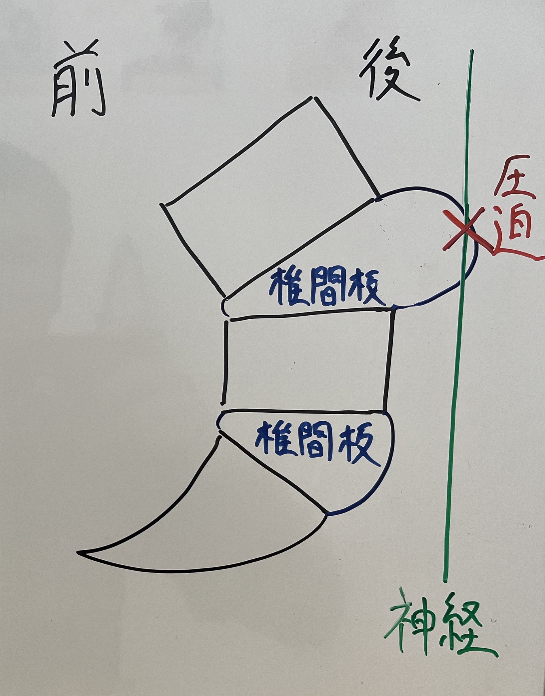 腰痛の症状と影響